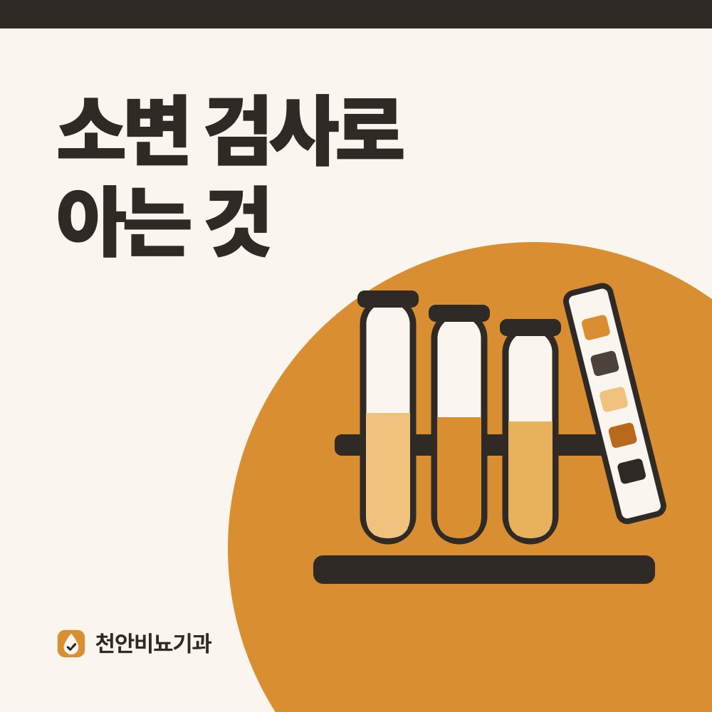 소변 검사로 아는 것
